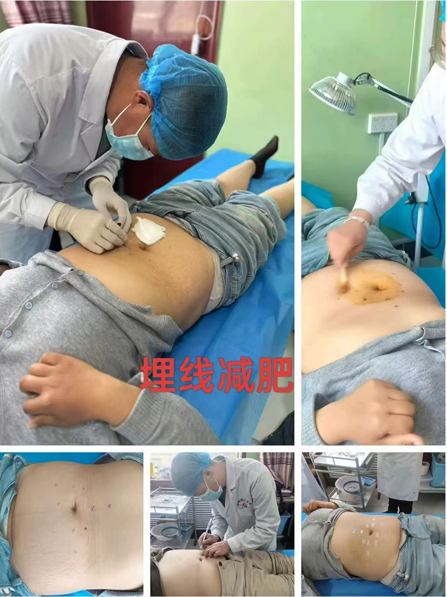 【杏林妙手】罗国宝：扎根基层，以中医妙术守护百姓安康